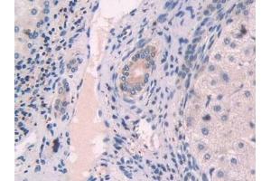 Immunohistochemistry (IHC) image for anti-2',5'-Oligoadenylate Synthetase 1, 40/46kDa (OAS1) (AA 74-165) antibody (ABIN7435079)