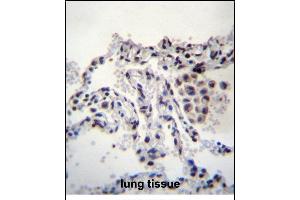 MEIG1 Antibody (Center) (ABIN656380 and ABIN2845675) immunohistochemistry analysis in formalin fixed and paraffin embedded human lung tissue followed by peroxidase conjugation of the secondary antibody and DAB staining. (MEIG1 抗体  (AA 36-65))