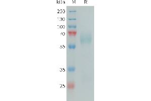 Human SAP Protein, His Tag on SDS-PAGE under reducing condition.