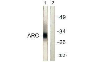 Western blot analysis of extracts from HeLa cells, using ARC antibody. (ARC 抗体)