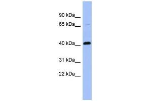 WB Suggested Anti-CFP Antibody Titration: 0. (CFP 抗体  (N-Term))