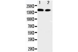 Anti-ErbB 4 antibody, Western blotting Lane 1: A549 Cell Lysate Lane 2: HELA Cell Lysate (ERBB4 抗体  (N-Term))