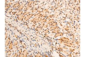 Immunohistochemistry (IHC) image for anti-Nuclear Factor of kappa Light Polypeptide Gene Enhancer in B-Cells Inhibitor, alpha (NFKBIA) (pSer32), (pSer36) antibody (ABIN6256292)