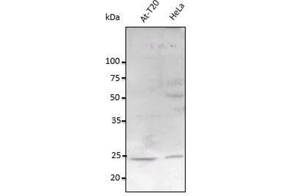 RAB11A 抗体  (C-Term)