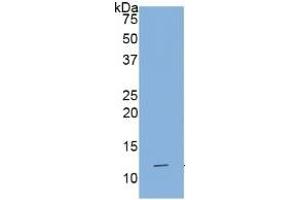 Western Blotting (WB) image for Interleukin 1 Receptor, Type I (IL1R1) ELISA Kit (ABIN6730877)