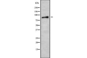 Western blot analysis of AMPD3 using MCF7 whole cell lysates (AMPD3 抗体  (Internal Region))