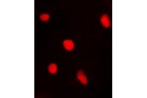 Immunofluorescent analysis of BTEB1 staining in A549 cells. (KLF9 抗体)