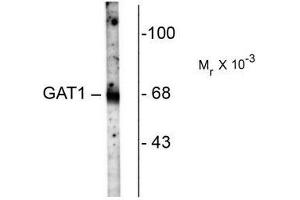 Image no. 1 for anti-GABA Transporter 1 (GAT1) (C-Term) antibody (ABIN372646) (SLC6A1 抗体  (C-Term))