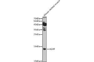 Western blot analysis of extracts of Mouse skeletal muscle, using AGRP antibody (ABIN7265515) at 1:1000 dilution. (AGRP 抗体  (AA 21-132))