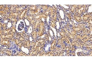 Immunohistochemistry (IHC) image for anti-Serpin Family A Member 7 (SERPINA7) (AA 128-415) antibody (ABIN7429163)