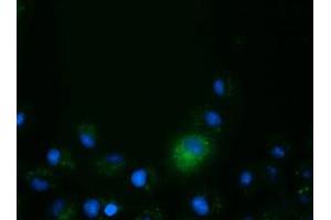 Anti-CD80 mouse monoclonal antibody (ABIN2452902) immunofluorescent staining of COS7 cells transiently transfected by pCMV6-ENTRY CD80 (RC206540). (CD80 抗体)
