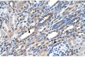 Immunohistochemistry (IHC) image for anti-Nucleolar and Coiled-Body Phosphoprotein 1 (NOLC1) (C-Term) antibody (ABIN2782491)