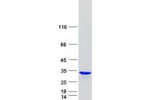 Western Blotting (WB) image for GID Complex Subunit 8 Homolog (GID8) protein (Myc-DYKDDDDK Tag) (ABIN2715470)
