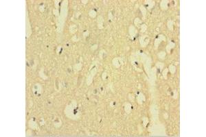 Immunohistochemistry of paraffin-embedded human brain tissue using ABIN7143589 at dilution of 1:100 (Aftiphilin 抗体  (AA 752-889))