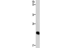 Gel: 12 % SDS-PAGE, Lysate: 40 μg, Lane: MCF7 cells, Primary antibody: ABIN7192097(RAB22A Antibody) at dilution 1/650, Secondary antibody: Goat anti rabbit IgG at 1/8000 dilution, Exposure time: 30 seconds (RAB22A 抗体)