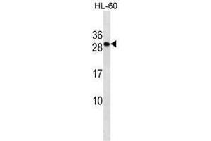 TMED6 Antibody (Center) western blot analysis in HL-60 cell line lysates (35 µg/lane). (TMED6 抗体  (Middle Region))