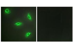 Immunofluorescence analysis of HeLa cells, using TNF14 antibody. (TNFSF14 抗体  (Internal Region))