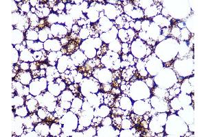 Immunohistochemistry of paraffin-embedded rat brown adipose using Perilipin A Rabbit mAb (ABIN7269218) at dilution of 1:100 (40x lens). (PLIN1 抗体)