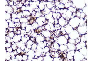 Immunohistochemistry of paraffin-embedded rat brown adipose using Perilipin A Rabbit mAb (ABIN7269218) at dilution of 1:100 (40x lens).