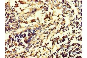 Immunohistochemistry of paraffin-embedded human appendix tissue using ABIN7154641 at dilution of 1:100 (RHEBL1 抗体  (AA 1-180))