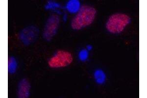 Immunostaining of primary rat cortical neuroepithelial cells with anti-Olig2 (red). (OLIG2 抗体)