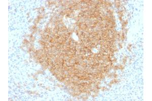 Immunohistochemistry (IHC) image for anti-CD40 (CD40) antibody (ABIN6941185)