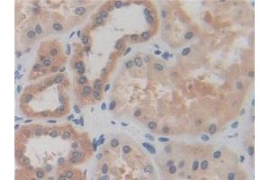 Detection of IREB2 in Human Kidney Tissue using Polyclonal Antibody to Iron Responsive Element Binding Protein 2 (IREB2) (IREB2 抗体  (AA 39-281))