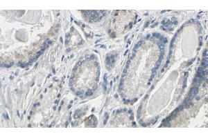 ABIN6274786 at 1/100 staining Human prostate tissue by IHC-P. (PGLS 抗体  (C-Term))