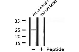 Western blot analysis of extracts from mouse brain, using RPL10 Antibody. (RPL10 抗体  (N-Term))
