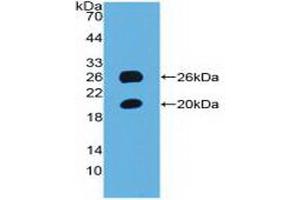 Detection of Recombinant SPON1, Mouse using Polyclonal Antibody to Spondin 1 (SPON1) (SPON1 抗体  (AA 608-802))