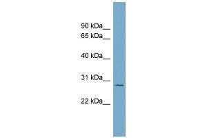 WB Suggested Anti-C1orf96 Antibody Titration: 0. (CCSAP 抗体  (N-Term))
