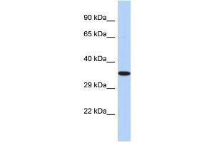 Western Blotting (WB) image for anti-Epoxide Hydrolase 4 (EPHX4) (C-Term) antibody (ABIN2786305) (EPHX4 抗体  (C-Term))