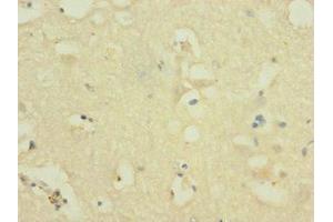Immunohistochemistry of paraffin-embedded human brain tissue using ABIN7161009 at dilution of 1:100 (NOX3 抗体  (AA 223-395))