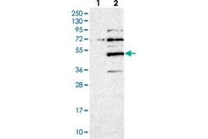 Western blot analysis of Lane 1: Negative control (vector only transfected HEK293T lysate), Lane 2: Over-expression Lysate (Co-expressed with a C-terminal myc-DDK tag (~3. (SERTAD4 抗体)