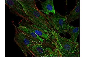 Immunocytochemistry staining of AHNAK1 in human primary fibroblasts using anti-AHNAK1 (EM-09, green).