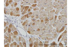Immunoperoxidase of monoclonal antibody to ACADVL on formalin-fixed paraffin-embedded human heart. (ACADVL 抗体  (AA 345-434))