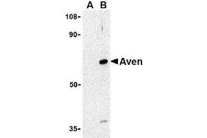 Western blot analysis of Aven in Raji cell lysate with AP30099PU-N Aven antibody at 1 μg/ml in (A) the presence and (B) the absence of blocking peptide. (AVEN 抗体  (N-Term))
