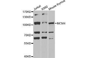 Western blot analysis of extracts of various cell lines, using MCM4 antibody (ABIN5971548) at 1:400 dilution. (MCM4 抗体)