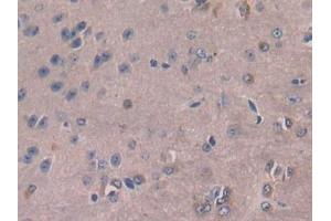 DAB staining on IHC-P; Samples: Mouse Cerebrum Tissue (M-CSF/CSF1 抗体  (AA 33-204))