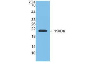 Western blot analysis of recombinant Rat MMP9. (MMP 9 抗体  (AA 226-391))