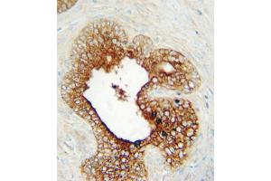 Immunohistochemistry (IHC) image for anti-Lymphocyte-Activation Gene 3 (LAG3) antibody (ABIN3002914) (LAG3 抗体)