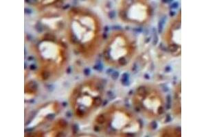 Used in DAB staining on fromalin fixed paraffin-embedded Kidney tissue (PKC zeta 抗体  (AA 254-484))