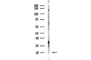 anti-Cytochrome B-561 Domain Containing 1 (CYB561D1) (C-Term) antibody