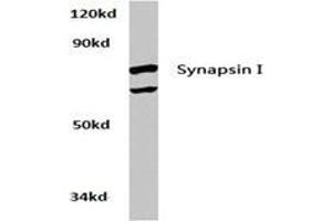 Western blot analysis of Synapsin-1 Antibody  in extracts from Hela cells at 1/500 dilution. (SYN1 抗体)