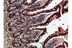 Immunohistochemistry (IHC) image for anti-Gremlin 2 (GREM2) (AA 71-120) antibody (ABIN7189526)