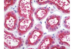 anti-PDZ Domain Containing 1 (PDZK1) antibody