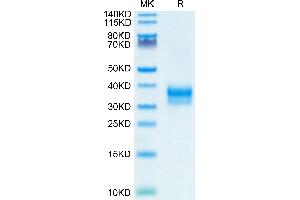 SDS-PAGE (SDS) image for Sialic Acid Binding Ig-Like Lectin 15 (SIGLEC15) (AA 24-262) protein (His tag) (ABIN7275614)