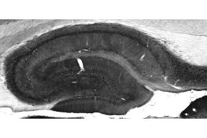 Adult rat hippocampus immunohistochemistry.