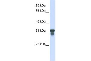 Western Blotting (WB) image for anti-Solute Carrier Family 25 (Mitochondrial Carrier, Oxoglutarate Carrier), Member 11 (SLC25A11) (C-Term) antibody (ABIN2781592)