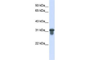 WB Suggested Anti-SLC25A11 Antibody Titration:  0. (SLC25A11 抗体  (C-Term))